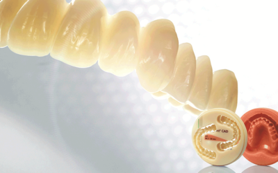 Ivoclar Digital Dentures coming soon to Nash Dental Lab!